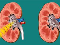 kidneys.jpg