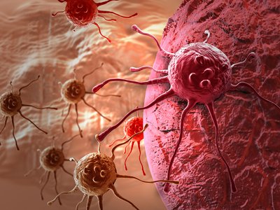 cancer-cell.jpg