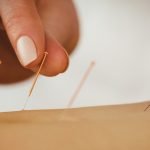 Electroacupuncture and Constipation